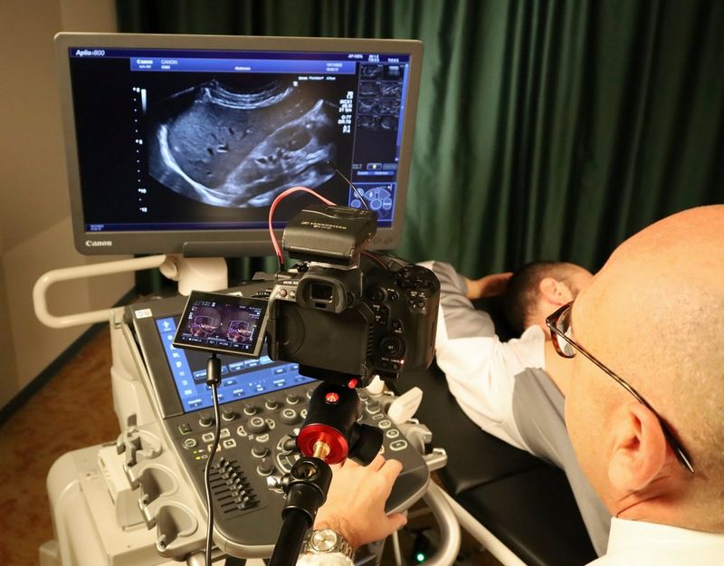 EOS R5 C RF 5.2mm F2.8L DUAL FISHEYE Canon Medical Systems Case Study 02