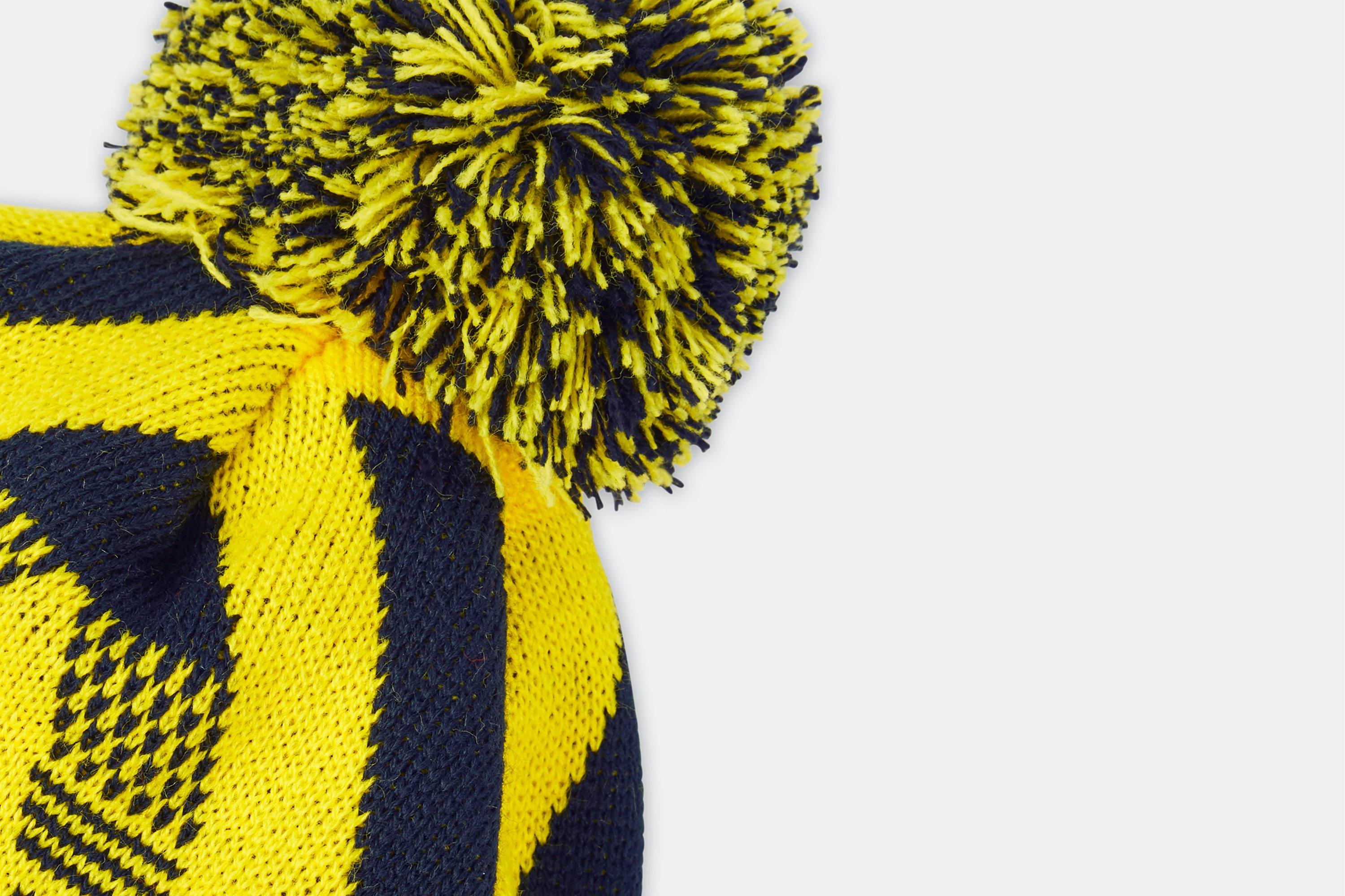 arsenal direct bruised banana