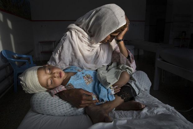 March 29, 2016, Kabul, Afghanistan C Najiba holds her nephew Shabir, who was injured in a bomb blast that killed his sister. The bomb exploded in a relatively peaceful part of Kabul while Shabirs mother was walking the children to school.