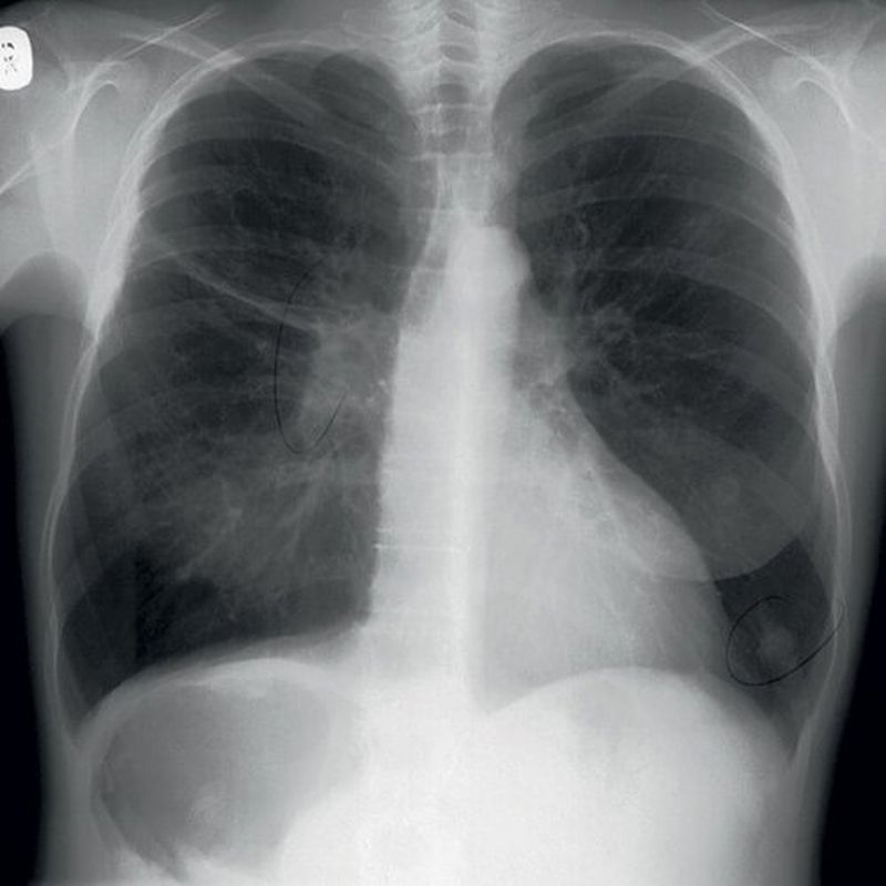 Simuation and design hero image X-Ray close up demonstration