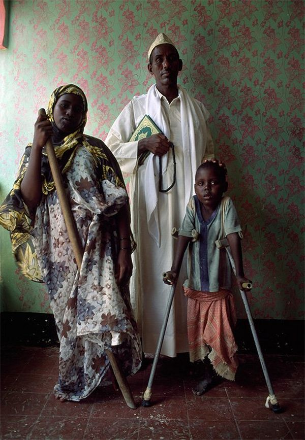 A man, woman and child stand in a room with patterned wallpaper. The child is supported with crutches and the woman with a staff.