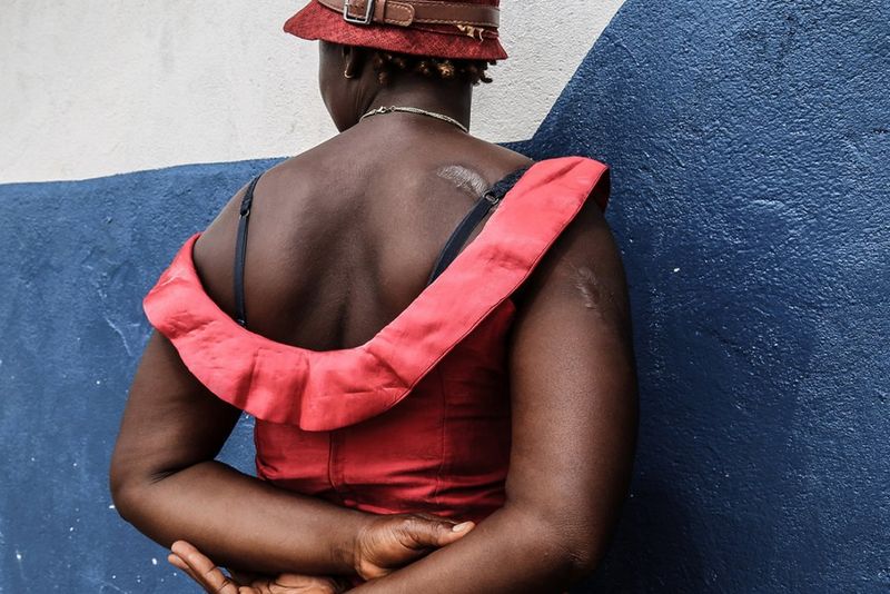 ‘The Process of Re-Learning Bodies’ by Yagazie Emezie photograph showing no VI impairment simulation