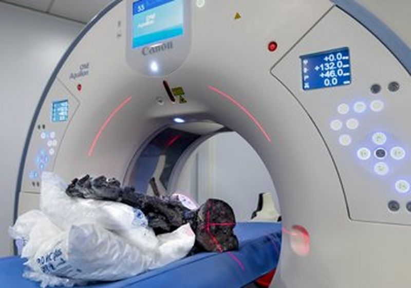 A Canon Medical Aquilion ONE / PRISM Edition CT scanner. On the scanner bed lies plastic covered cushions, on top of which are the fossilised bones of a dinosaur.