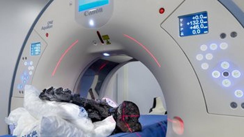 Een Canon Medical Aquilion ONE / PRISM Edition CT-scanner. Op de scanner liggen met plastic bedekte kussens waarop de versteende botten van een dinosaurus liggen.